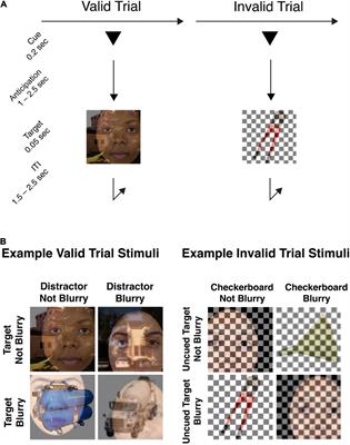 Anticipatory attention is a stable state induced by transient control mechanisms